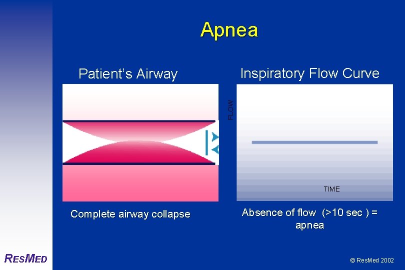 Apnea Inspiratory Flow Curve FLOW Patient’s Airway TIME Complete airway collapse RESMED Absence of