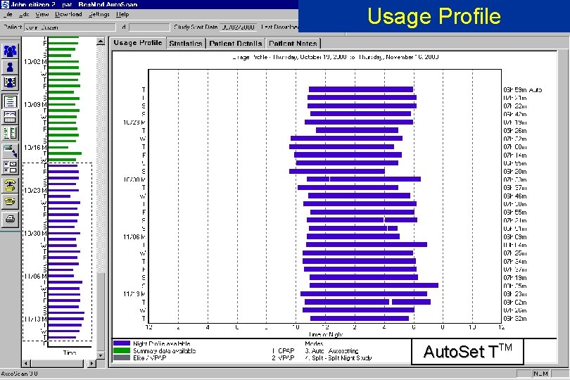 Usage Profile RESMED Auto. Set TTM © Res. Med 2002 