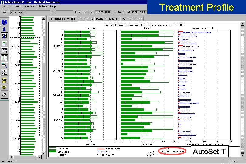 Treatment Profile RESMED Auto. Set T © Res. Med 2002 