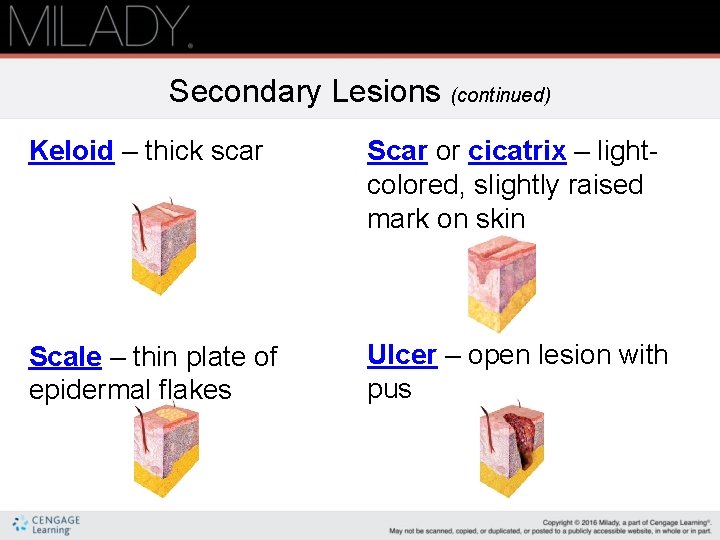 Secondary Lesions (continued) Keloid – thick scar Scar or cicatrix – lightcolored, slightly raised