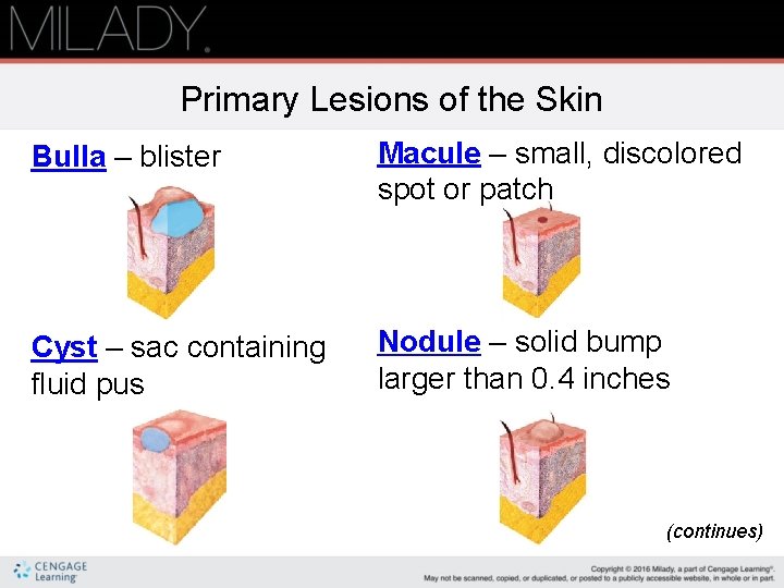 Primary Lesions of the Skin Bulla – blister Macule – small, discolored spot or