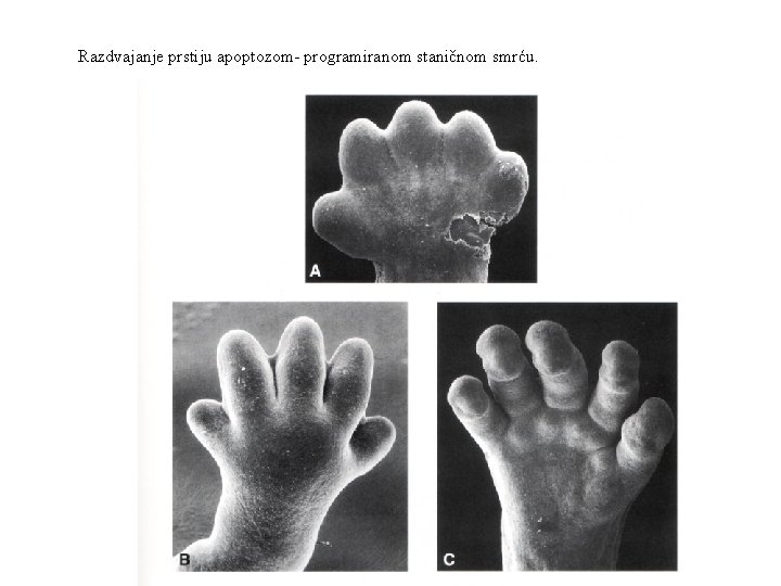 Razdvajanje prstiju apoptozom- programiranom staničnom smrću. 