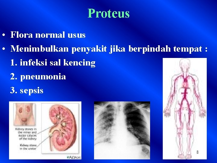 Proteus • Flora normal usus • Menimbulkan penyakit jika berpindah tempat : 1. infeksi