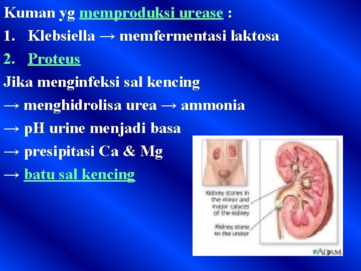 Kuman yg memproduksi urease : 1. Klebsiella → memfermentasi laktosa 2. Proteus Jika menginfeksi