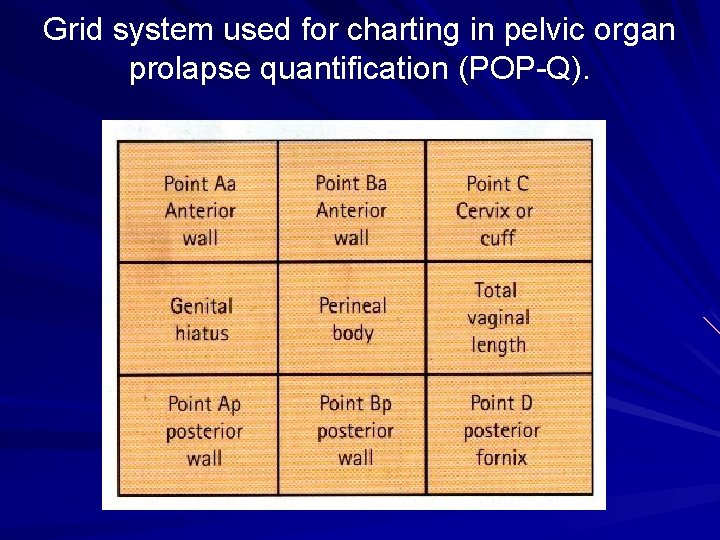 Grid system used for charting in pelvic organ prolapse quantification (POP-Q). 