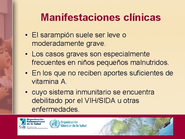 Manifestaciones clínicas • El sarampión suele ser leve o moderadamente grave. • Los casos