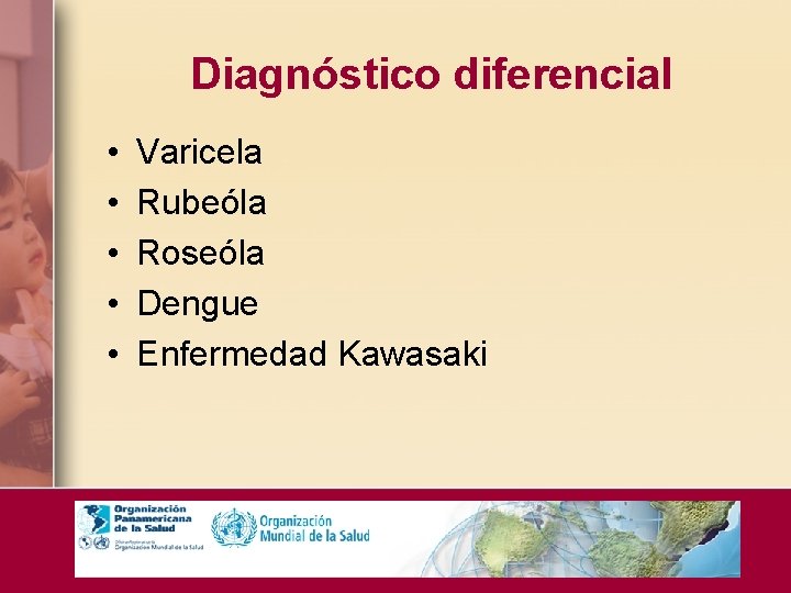 Diagnóstico diferencial • • • Varicela Rubeóla Roseóla Dengue Enfermedad Kawasaki 