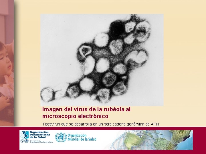 Imagen del virus de la rubéola al microscopio electrónico Togavirus que se desarrolla en