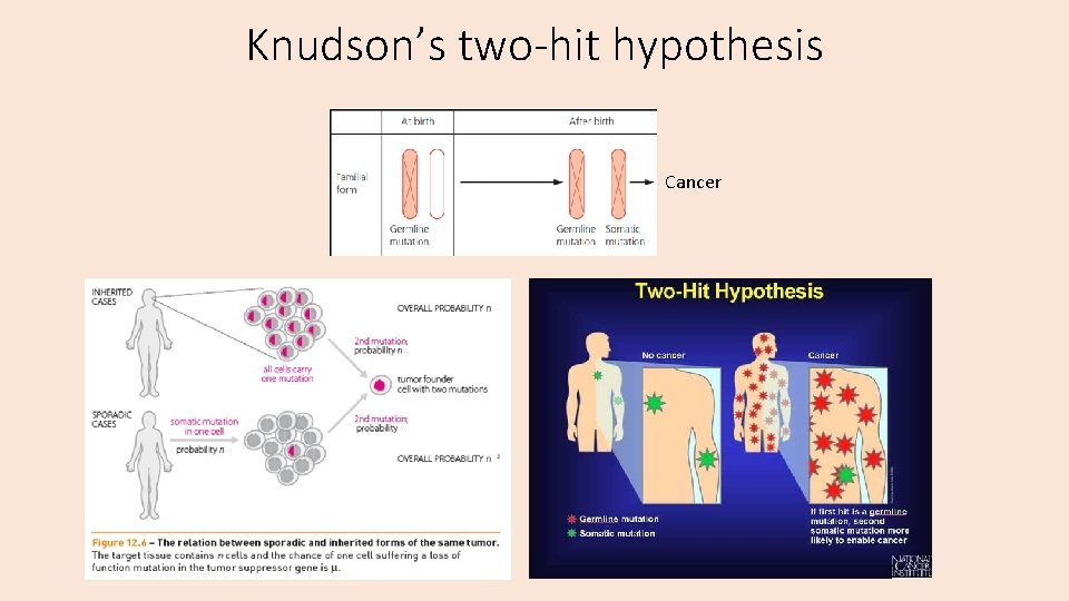 Knudson’s two-hit hypothesis Cancer 