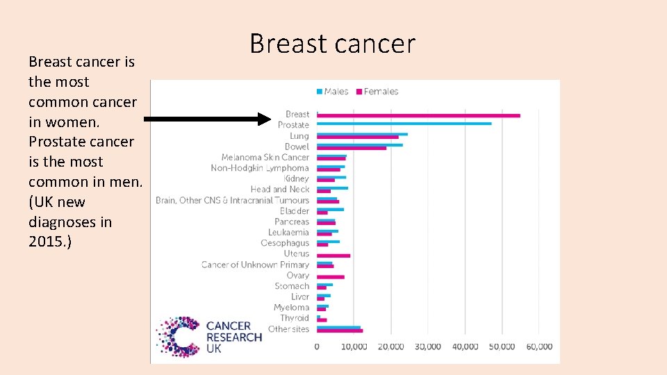 Breast cancer is the most common cancer in women. Prostate cancer is the most