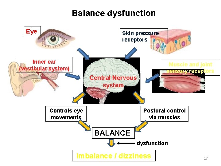 Balance dysfunction Eye Skin pressure receptors Inner ear (vestibular system) Muscle and joint sensory