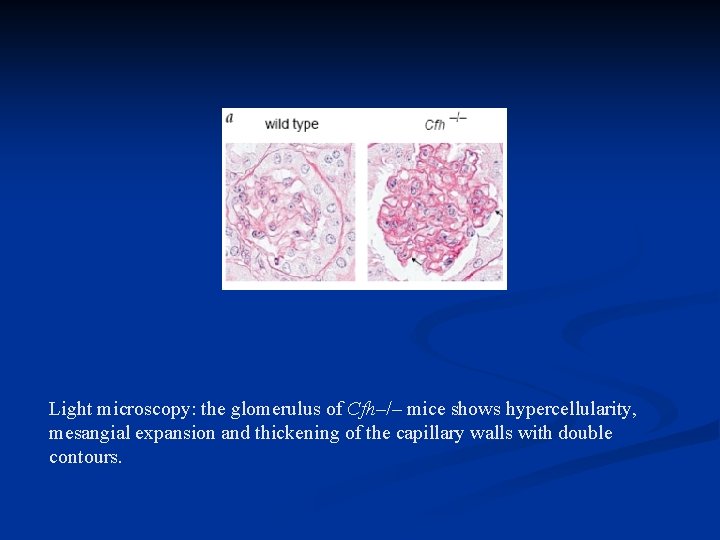 Light microscopy: the glomerulus of Cfh–/– mice shows hypercellularity, mesangial expansion and thickening of
