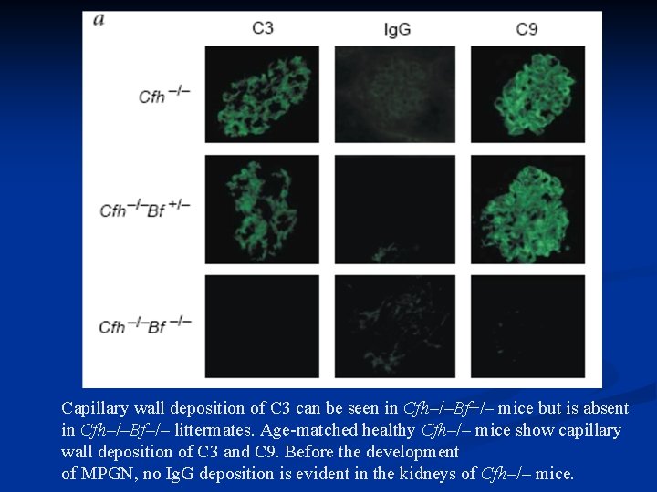Capillary wall deposition of C 3 can be seen in Cfh–/–Bf+/– mice but is