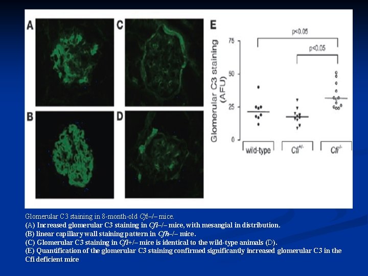 Glomerular C 3 staining in 8 -month-old Cfi–/– mice. (A) Increased glomerular C 3
