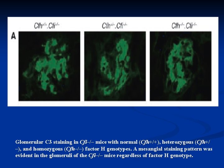 Glomerular C 3 staining in Cfi–/– mice with normal (Cfh+/+), heterozygous (Cfh+/ –), and