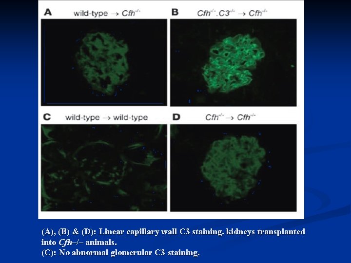 (A), (B) & (D): Linear capillary wall C 3 staining. kidneys transplanted into Cfh–/–