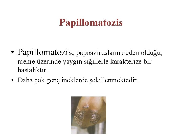 Papillomatozis • Papillomatozis, papoavirusların neden olduğu, meme üzerinde yaygın siğillerle karakterize bir hastalıktır. •