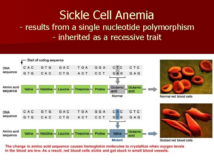 Sickle Cell Anemia - results from a single nucleotide polymorphism - inherited as a
