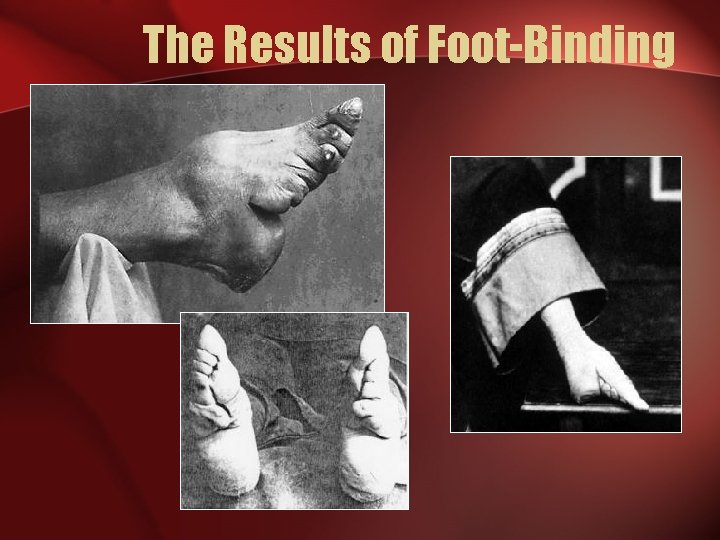 The Results of Foot-Binding 