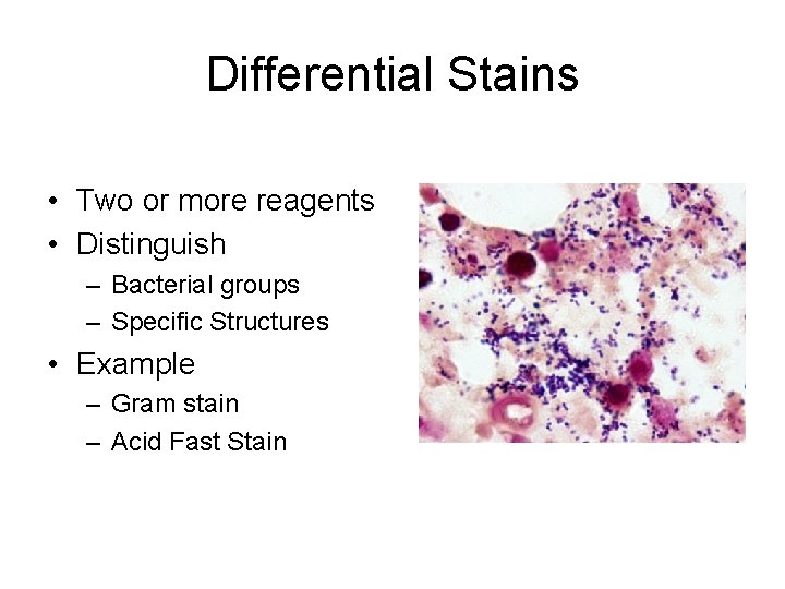 Differential Stains • Two or more reagents • Distinguish – Bacterial groups – Specific