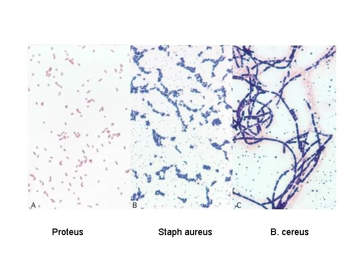 Proteus Staph aureus B. cereus 