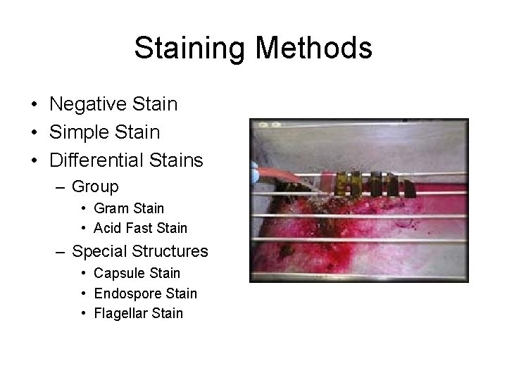 Staining Methods • Negative Stain • Simple Stain • Differential Stains – Group •