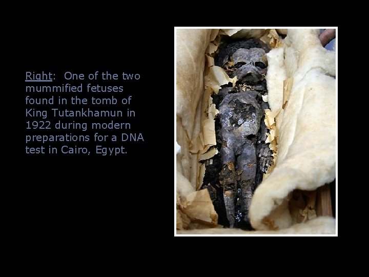 Right: One of the two mummified fetuses found in the tomb of King Tutankhamun