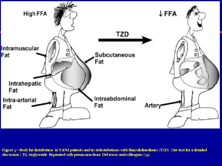 Figure 3—Body fat distribution in T 2 DM patients and its redistributions with thiazolidinediones