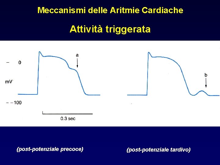 Meccanismi delle Aritmie Cardiache Attività triggerata (post-potenziale precoce) (post-potenziale tardivo) 