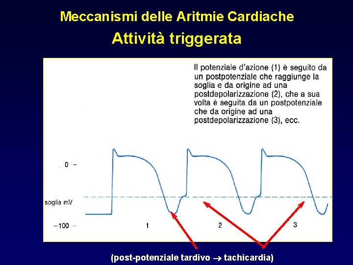 Meccanismi delle Aritmie Cardiache Attività triggerata (post-potenziale tardivo tachicardia) 