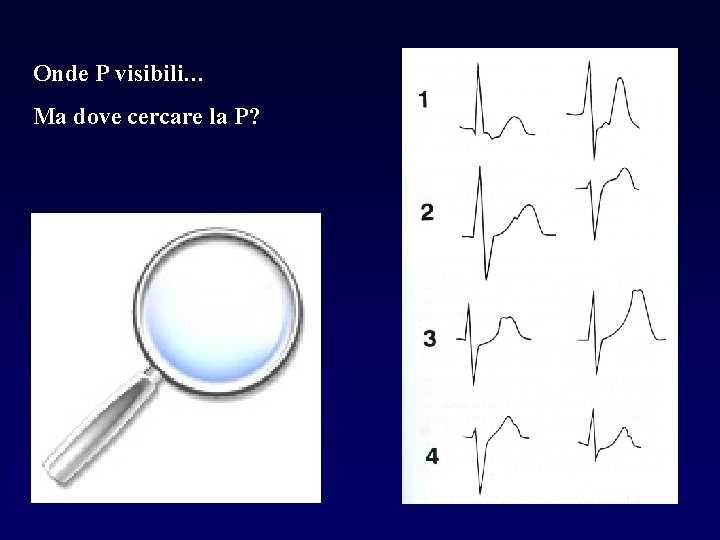 Onde P visibili… Ma dove cercare la P? 