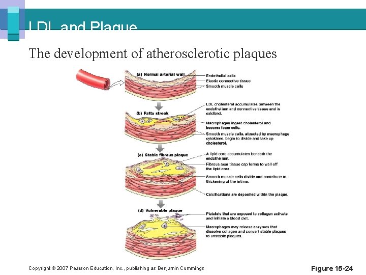 LDL and Plaque The development of atherosclerotic plaques Copyright © 2007 Pearson Education, Inc.