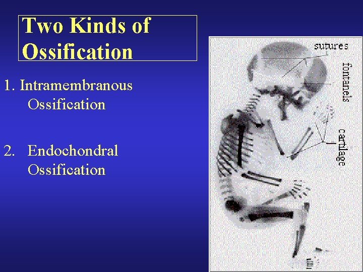 Two Kinds of Ossification 1. Intramembranous Ossification 2. Endochondral Ossification Two Kinds of Ossification 1. Intramembranous Ossification 2. Endochondral Ossification