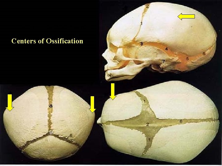 Centers of Ossification Centers of Ossification