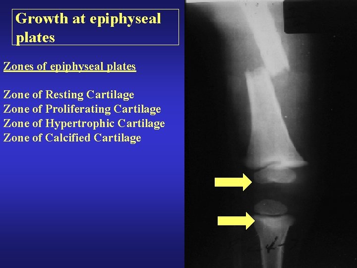 Growth at epiphyseal plates Zones of epiphyseal plates Zone of Resting Cartilage Zone of Growth at epiphyseal plates Zones of epiphyseal plates Zone of Resting Cartilage Zone of