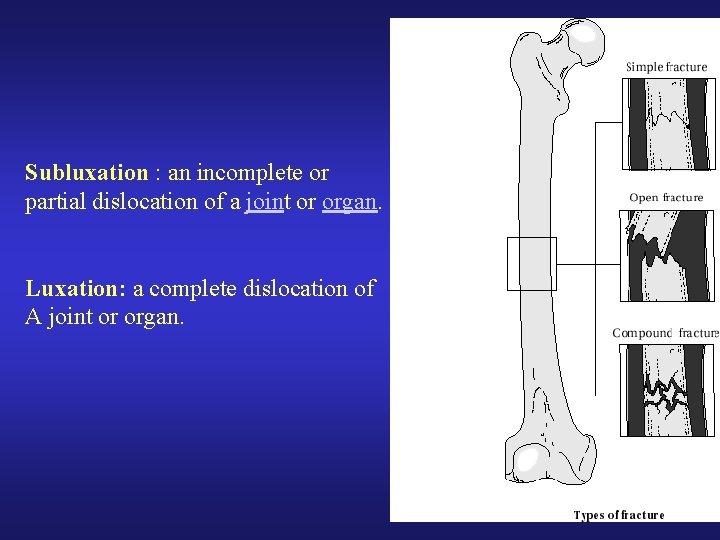 Subluxation : an incomplete or partial dislocation of a joint or organ. Luxation: a Subluxation : an incomplete or partial dislocation of a joint or organ. Luxation: a