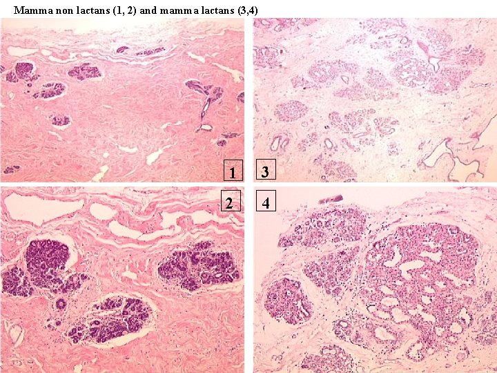 Mamma non lactans (1, 2) and mamma lactans (3, 4) 1 3 2 4