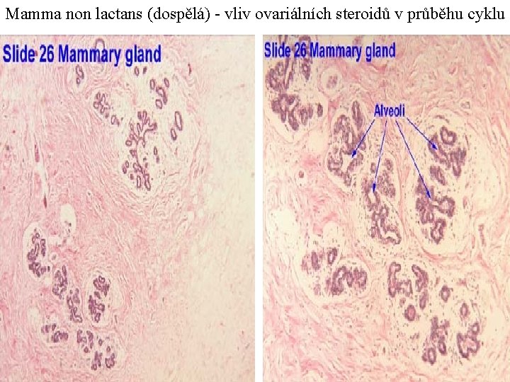 Mamma non lactans (dospělá) - vliv ovariálních steroidů v průběhu cyklu 