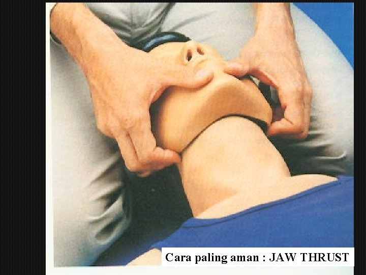 Cara paling aman : JAW THRUST 17 