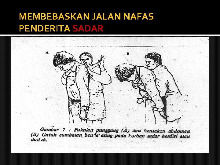 MEMBEBASKAN JALAN NAFAS PENDERITA SADAR 