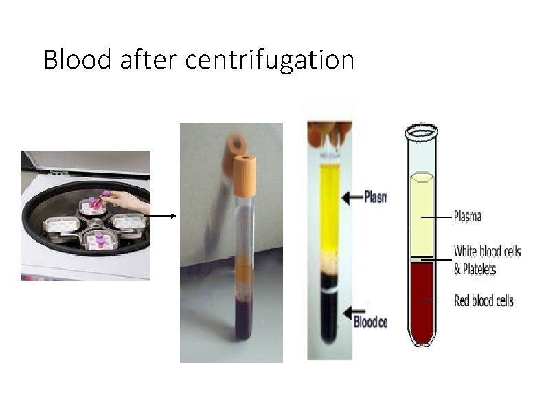 Blood after centrifugation 