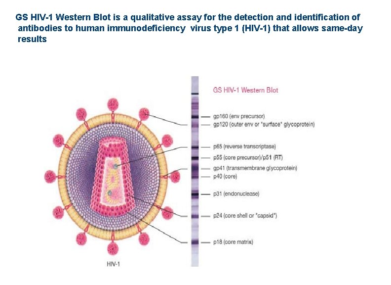GS HIV-1 Western Blot is a qualitative assay for the detection and identification of