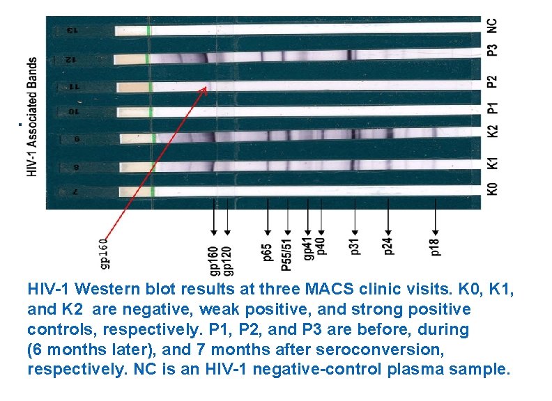 . HIV-1 Western blot results at three MACS clinic visits. K 0, K 1,