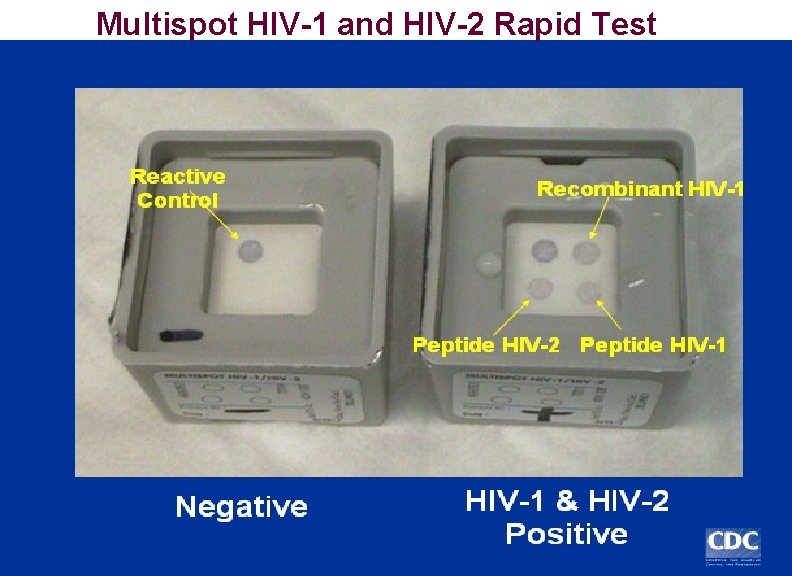Multispot HIV-1 and HIV-2 Rapid Test 