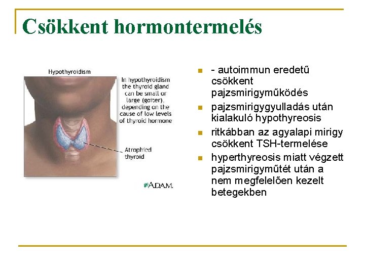 Csökkent hormontermelés n n - autoimmun eredetű csökkent pajzsmirigyműködés pajzsmirigygyulladás után kialakuló hypothyreosis ritkábban