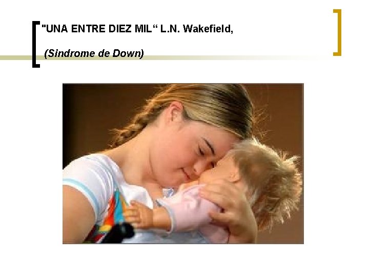 "UNA ENTRE DIEZ MIL“ L. N. Wakefield, (Sindrome de Down) 