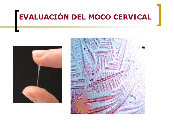 EVALUACIÓN DEL MOCO CERVICAL 