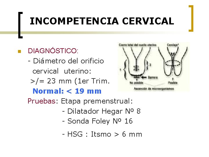 INCOMPETENCIA CERVICAL n DIAGNÓSTICO: - Diámetro del orificio cervical uterino: >/= 23 mm (1