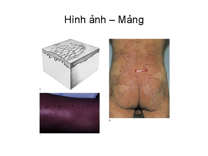 Hình ảnh – Mảng 