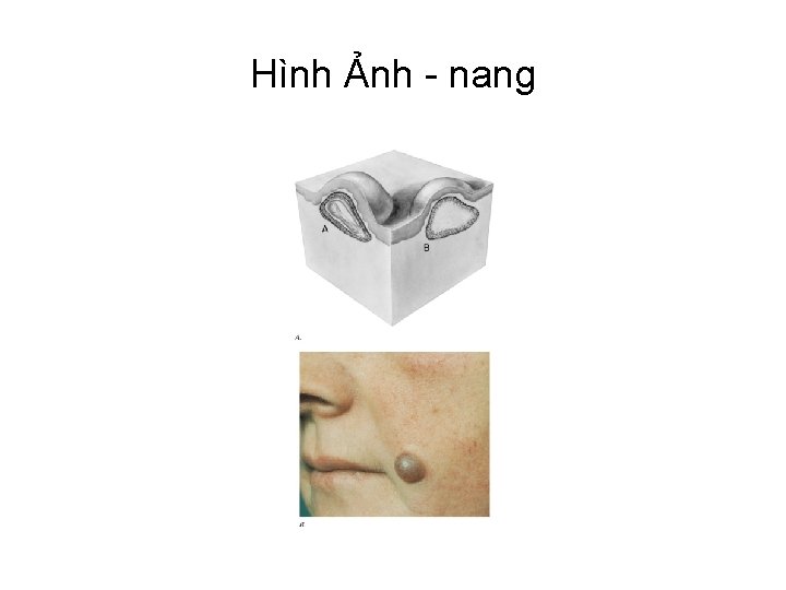 Hình Ảnh - nang 